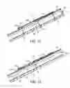 Fig. 14 - ABOVE-DECK ROOF VENTING ARTICLE