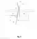 Fig. 03 - Gate Latch