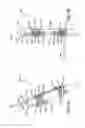 Fig. 04 - Object transfer system for a flight of steps