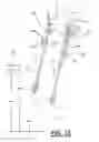 Fig. 15 - Interchangeable bail link apparatus and method