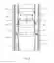 Fig. 03 - Remedial second-stage cementing packer