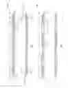 Fig. 03 - Downhole packer