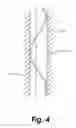 Fig. 05 - Bifurcated sliding seal
