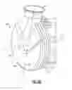 Fig. 14 - Modular mixer inlet and mixer assembly to provide for compact mixer