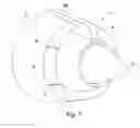 Fig. 02 - Nacelle for a turbojet engine with a variable nozzle