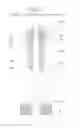Fig. 02 - Electromagnetic Fuel Injection Valve