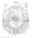 Fig. 11 - Differential device
