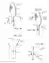 Fig. 05 - Electric lighting devices having a movable flame-shaped piece with a hollow interior
