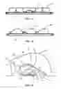 Fig. 11 - Multi-lens LED-array optic system
