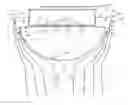 Fig. 01 - LED Luminaire Tertiary Optic System