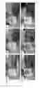 Fig. 08 - SWAB PORT FOR MICROFLUIDIC DEVICES