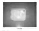 Fig. 12 - SWAB PORT FOR MICROFLUIDIC DEVICES