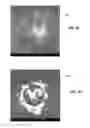 Fig. 05 - Nanotip sensor