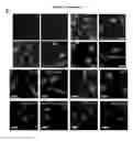 Fig. 04 - COMPOSITIONS AND METHODS FOR DETECTING AND TREATING GLIOBLASTOMA