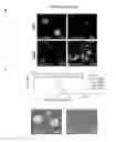Fig. 38 - COMPOSITIONS AND METHODS FOR DETECTING AND TREATING GLIOBLASTOMA