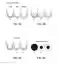 Fig. 05 - METHODS AND DEVICES FOR IMMUNODIAGNOSTIC APPLICATIONS