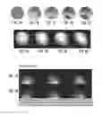 Fig. 09 - RF coil elements with split DC loops for magnetic resonance imaging systems for integrated parallel reception, excitation, and shimming and related methods and devices