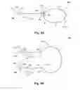 Fig. 06 - Double clad light diffusing fiber, connector system and illuminaire