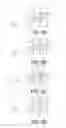 Fig. 06 - Substrate for mounting imaging element, and imaging device
