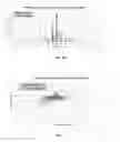 Fig. 03 - Method for designing contact lenses with semi-customized back surface