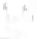 Fig. 96 - Eye glint imaging in see-through computer display systems