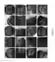 Fig. 06 - Method for driver face detection in videos