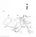 Fig. 07 - Method and system for image processing to determine patient-specific blood flow characteristics