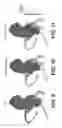 Fig. 08 - Method and system for image processing to determine patient-specific blood flow characteristics