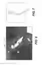 Fig. 06 - Method and system for image processing to determine patient-specific blood flow characteristics