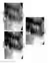 Fig. 03 - Imaging system and method for use in surgical and interventional medical procedures