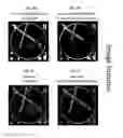 Fig. 08 - Imaging system and method for use in surgical and interventional medical procedures