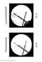 Fig. 09 - Imaging system and method for use in surgical and interventional medical procedures