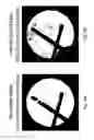 Fig. 10 - Imaging system and method for use in surgical and interventional medical procedures