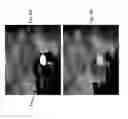 Fig. 12 - Imaging system and method for use in surgical and interventional medical procedures