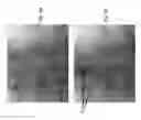 Fig. 13 - Imaging system and method for use in surgical and interventional medical procedures