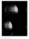 Fig. 14 - Imaging system and method for use in surgical and interventional medical procedures