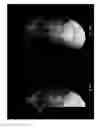 Fig. 15 - Imaging system and method for use in surgical and interventional medical procedures