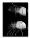 Fig. 18 - Imaging system and method for use in surgical and interventional medical procedures