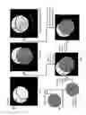 Fig. 20 - Imaging system and method for use in surgical and interventional medical procedures