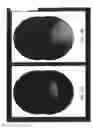 Fig. 22 - Imaging system and method for use in surgical and interventional medical procedures
