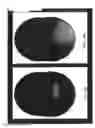 Fig. 23 - Imaging system and method for use in surgical and interventional medical procedures