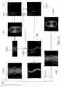 Fig. 13 - Systems and methods for metal artifact reduction