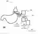 Fig. 01 - APPARATUS AND METHODS FOR CORRECTIVE GUIDANCE OF EATING BEHAVIOR AFTER WEIGHT LOSS SURGERY