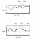 Fig. 26 - APPARATUS AND METHODS FOR CORRECTIVE GUIDANCE OF EATING BEHAVIOR AFTER WEIGHT LOSS SURGERY