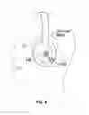 Fig. 04 - Active cancellation of noise in temporal bone