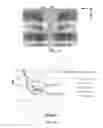 Fig. 07 - Waveguide of a write head with reduced cross sectional area proximate a near-field transducer