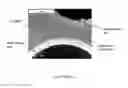 Fig. 10 - COMPOSITE METAL FOAM AND METHOD OF PREPARATION THEREOF