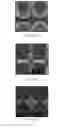 Fig. 15 - Nanoshape patterning techniques that allow high-speed and low-cost fabrication of nanoshape structures
