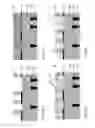 Fig. 06 - Method for forming contact vias
