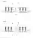 Fig. 11 - Thin film RDL for IC package